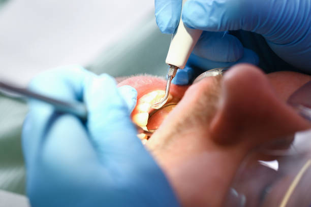 Best Urgent Dental Care in Shell Ridge, CA