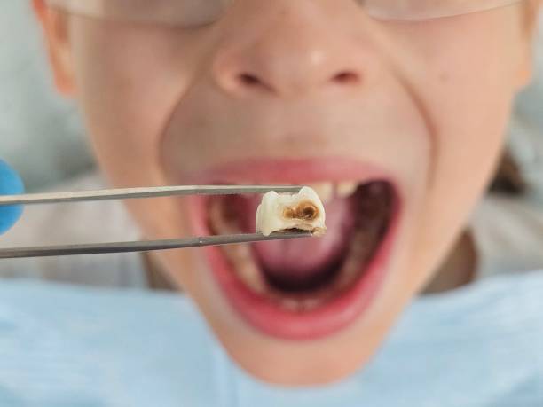 Best Emergency Dental Care for Trauma or Injury in Shell Ridge, CA