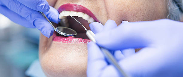 Best Emergency Root Canal Treatment in Shell Ridge, CA